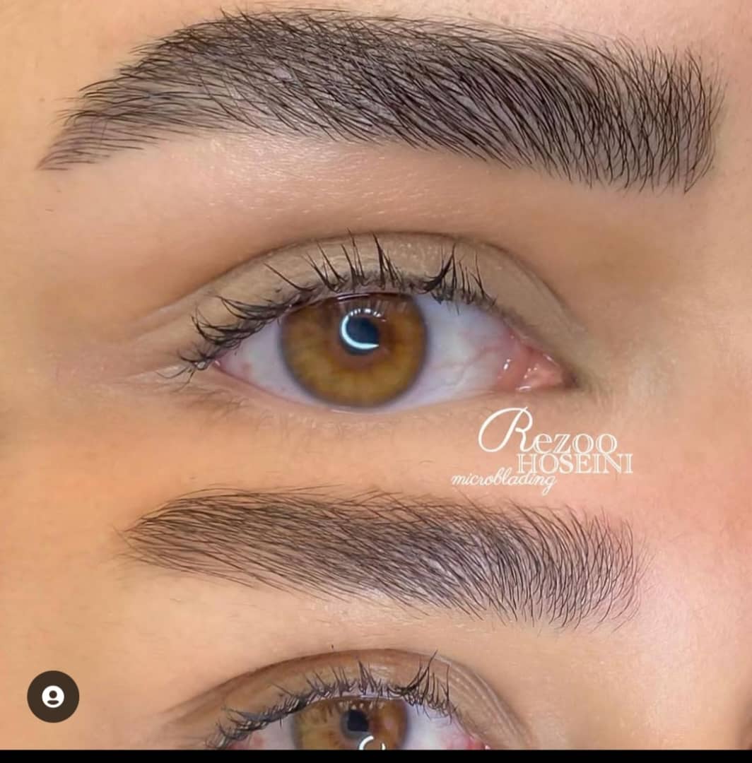 قبل وبعد میکرو بلید